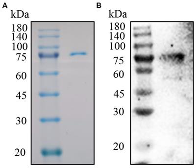 Development of an effective one-step double-antigen sandwich ELISA based on p72 to detect antibodies against African swine fever virus